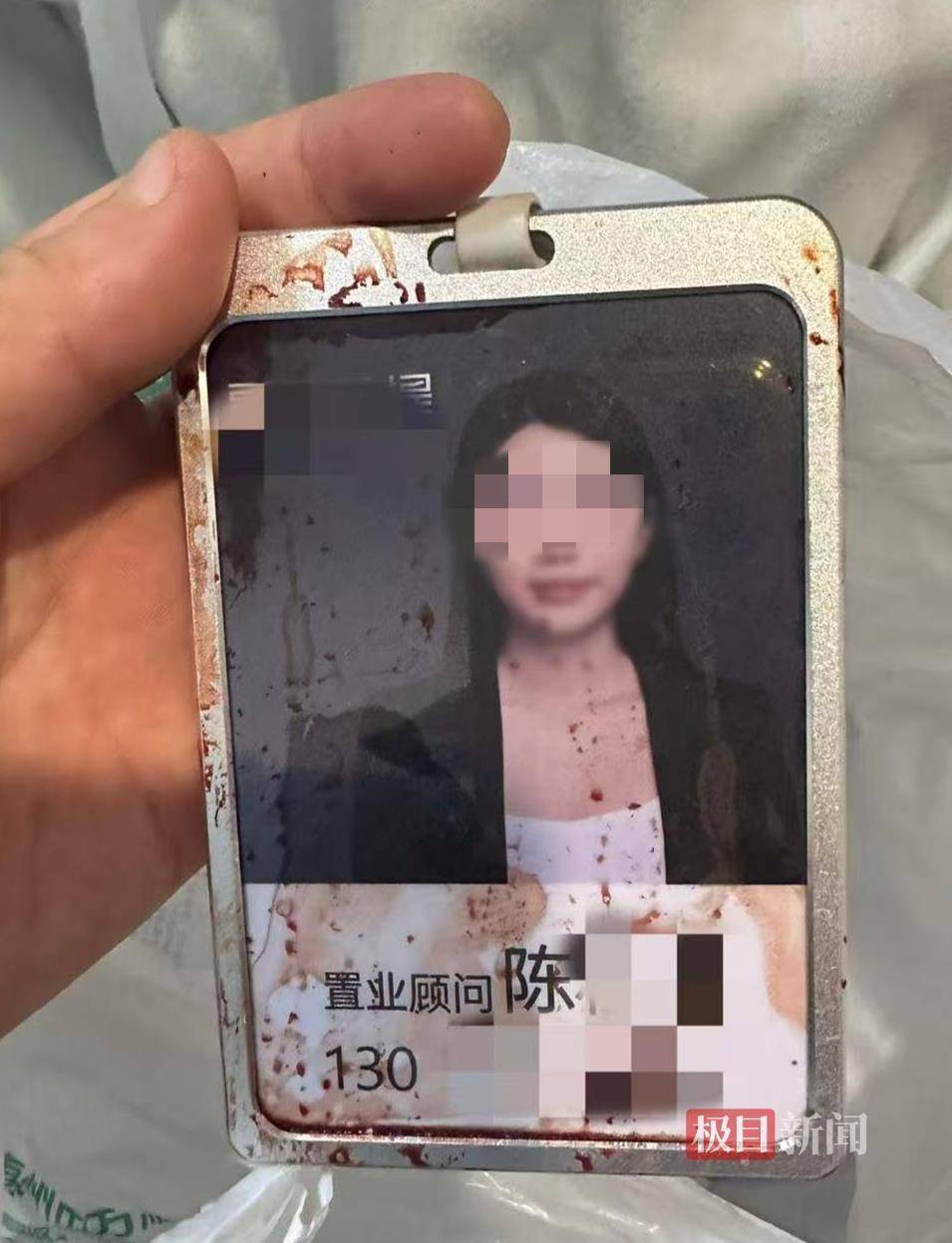 皇家苏斯达B队vs加的斯_“男子持水杯砸伤女同事被刑拘”后续:脸部缝20多针的女子已出院皇家苏斯达B队vs加的斯,否认抢单惹祸