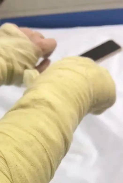 皇冠信用網网址
_女主播称遭伪装快递包裹炸伤皇冠信用網网址
，湖南警方通报